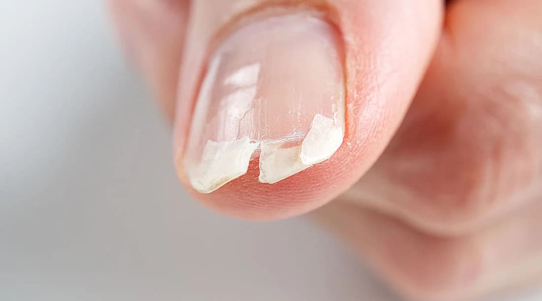 Extension de Réparation des Ongles (par ongle)